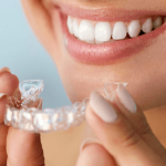 An Intro to Invisalign® Clear Aligners