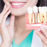 Missing Teeth? Here Are Your Implant Options