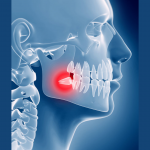 Les problèmes liés aux dents de sagesse: causes et solutions