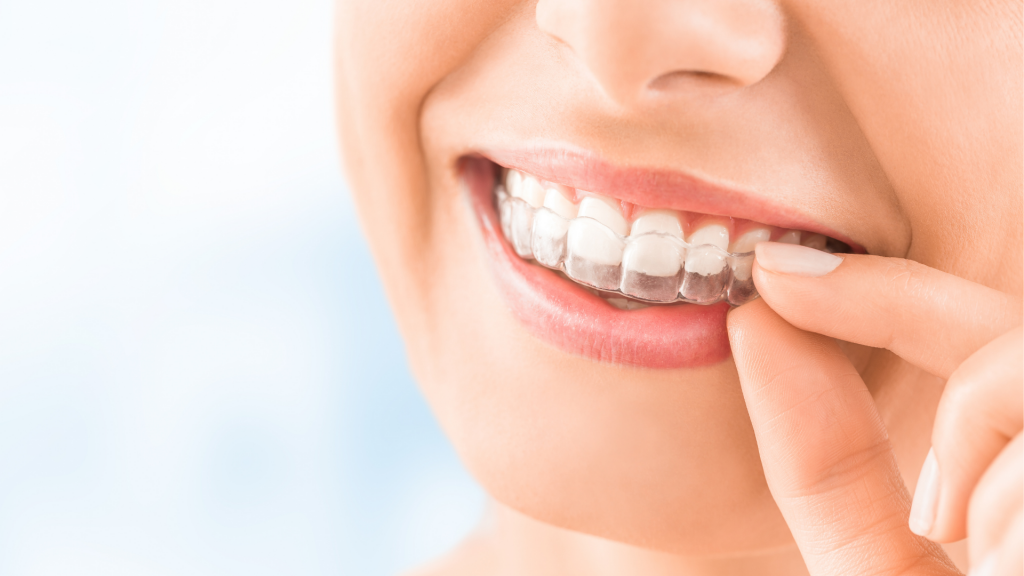 Tooth Tips | Is InvisalignÂ® Treatment Right For You?