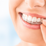 Tooth Tips | Is Invisalign® Treatment Right For You?