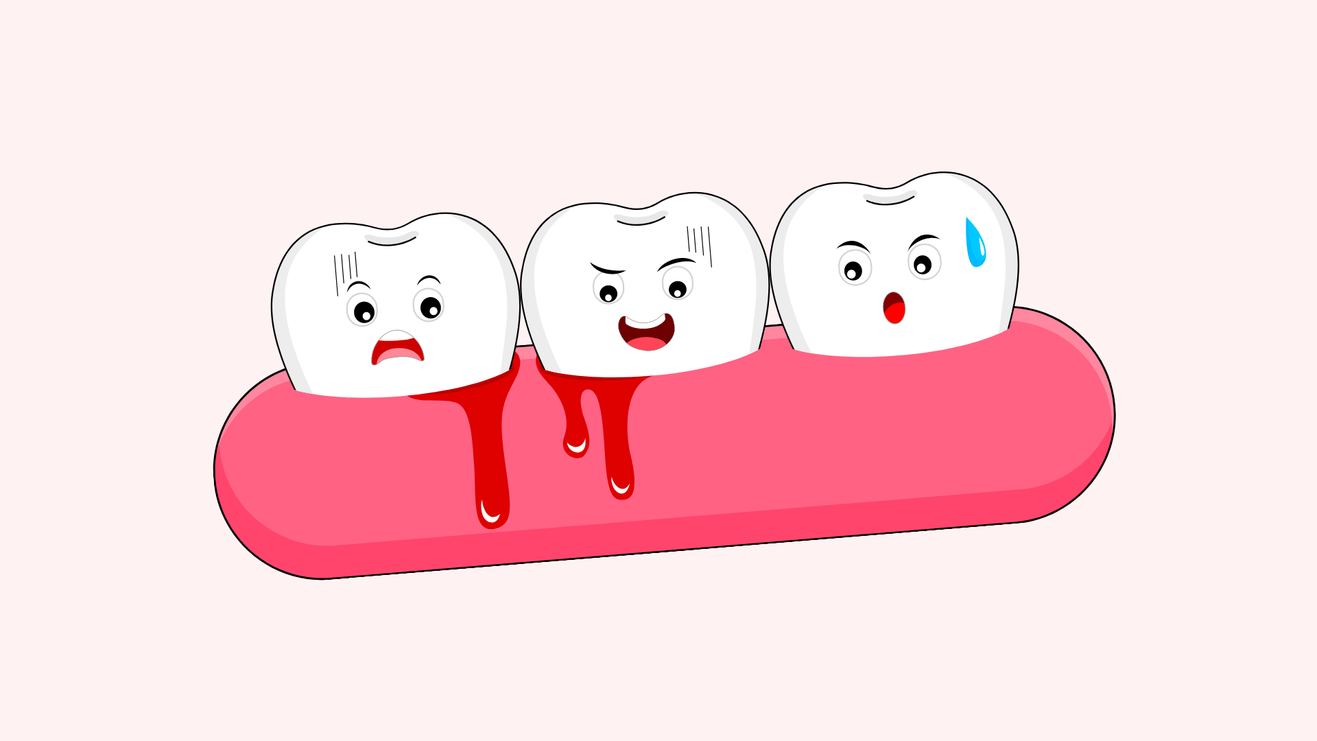 Tooth Tips | What Makes Your Gums Bleed